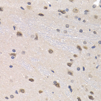 Immunohistochemistry - PTHLH Polyclonal Antibody 