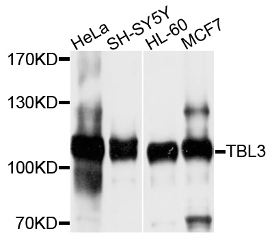 Western blot - TBL3 Polyclonal Antibody 