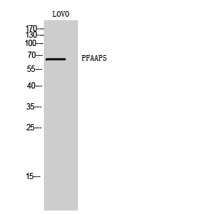 Fig1:; Western Blot analysis of LOVO cells using PFAAP5 Polyclonal Antibody