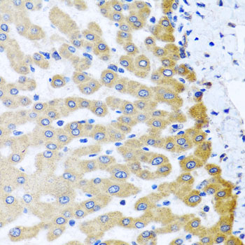 Immunohistochemistry - M6PR Polyclonal Antibody 