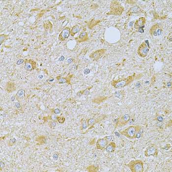 Immunohistochemistry - CAMK1G Polyclonal Antibody 