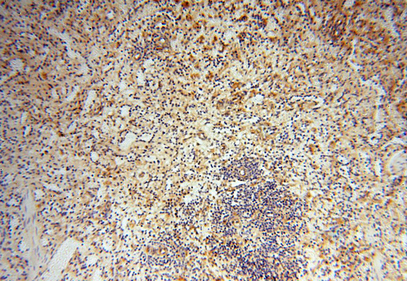 Immunohistochemical of paraffin-embedded human spleen using Catalog No:109028(CD33 antibody) at dilution of 1:100 (under 10x lens)