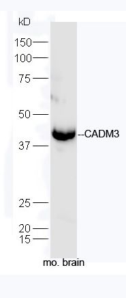 Fig2: Sample: Brain (Mouse) Lysate at 40 ug; Primary: Anti-CADM3 at 1/300 dilution; Secondary: HRP conjugated Goat-Anti-rabbit IgG (bs-0295G-HRP) at 1/5000 dilution; Predicted band size: 41 kD; Observed band size: 41 kD