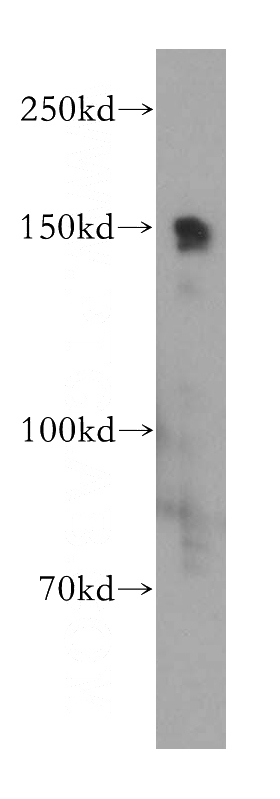 HepG2 cells were subjected to SDS PAGE followed by western blot with Catalog No:116772(PIK3R4 antibody) at dilution of 1:500