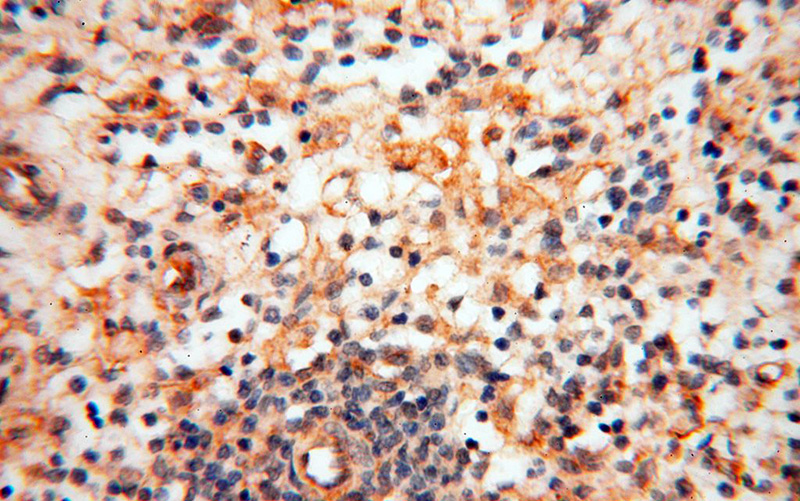 Immunohistochemical of paraffin-embedded human spleen using Catalog No:109028(CD33 antibody) at dilution of 1:100 (under 40x lens)