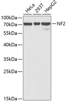 Western blot - NF2 Polyclonal Antibody 
