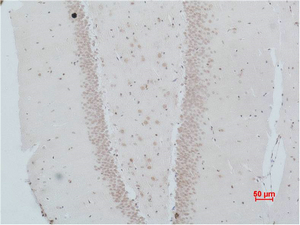 Fig2:; Immunohistochemical analysis of paraffin-embedded Rat Brain Tissue using NMBR Polyclonal Antibody.