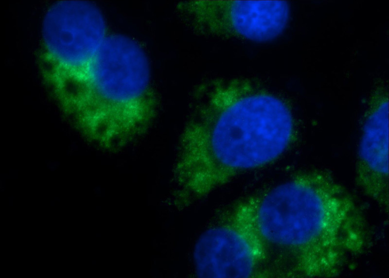 Immunofluorescent analysis of Chloroquine treated HepG2 cells using Catalog No:110800(ATG8L Antibody) at dilution of 1:50 and Alexa Fluor 488-congugated AffiniPure Goat Anti-Rabbit IgG(H+L)