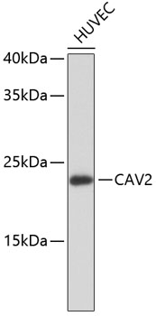Western blot - CAV2 Monoclonal Antibody 