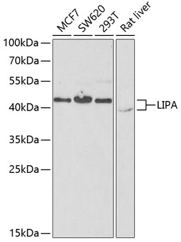 Western blot - LIPA Polyclonal Antibody 