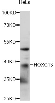 Western blot - HOXC13 Polyclonal Antibody 