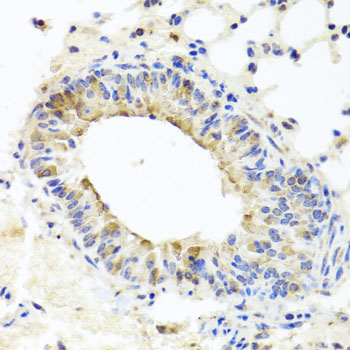 Immunohistochemistry - MUC16 Polyclonal Antibody 