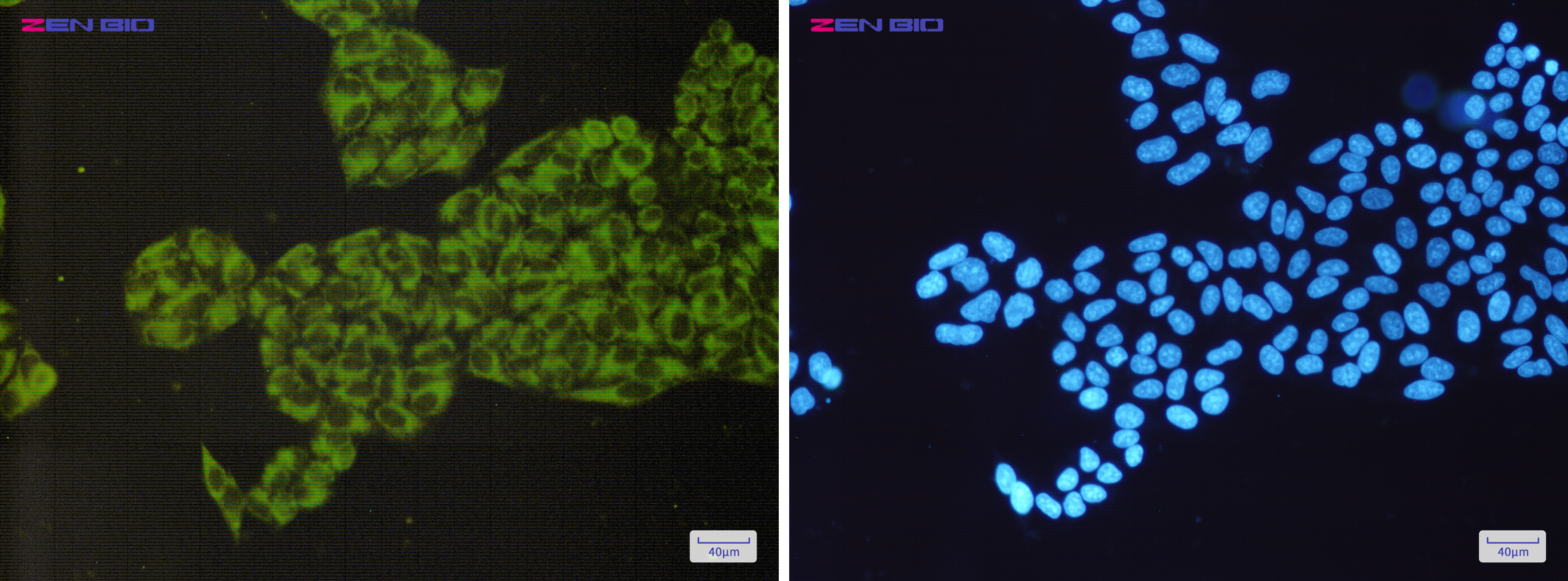 Immunocytochemistry of ORP150(green) in Hela cells using ORP150 Rabbit mAb at dilution 1/200, and DAPI(blue)