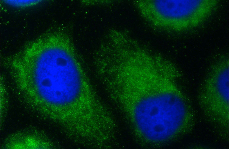 Immunofluorescent analysis of A431 cells using Catalog No:108806(C9orf9 Antibody) at dilution of 1:25 and Alexa Fluor 488-congugated AffiniPure Goat Anti-Rabbit IgG(H+L)