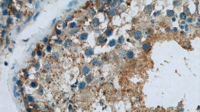 Immunohistochemistry of paraffin-embedded human testis slide using Catalog No:116658(UBQLN2 Antibody) at dilution of 1:50
