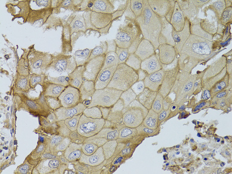 Immunohistochemistry - GGT1 Polyclonal Antibody 