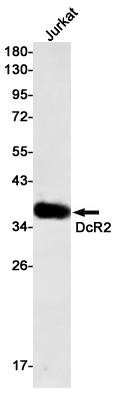 Western blot detection of DcR2 in Jurkat cell lysates using DcR2 Rabbit mAb(1:500 diluted).Predicted band size:42kDa.Observed band size:35kDa.