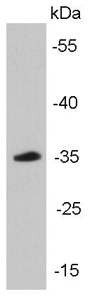 Fig1: Western blot analysis of cyclin D1 on mouse brain tissue lysates using anti-Cyclin D1 antibody at 1/5000 dilution.; Positive control: mouse brain