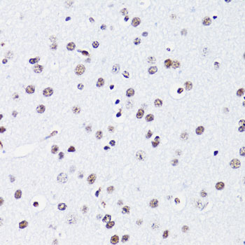 Immunohistochemistry - Acetyl-Histone H2B-K15 pAb 