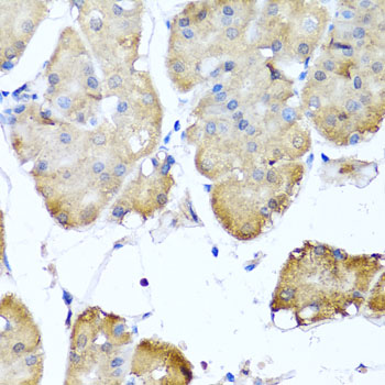 Immunohistochemistry - NIN Polyclonal Antibody 