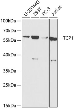 Western blot - TCP1 Polyclonal Antibody 