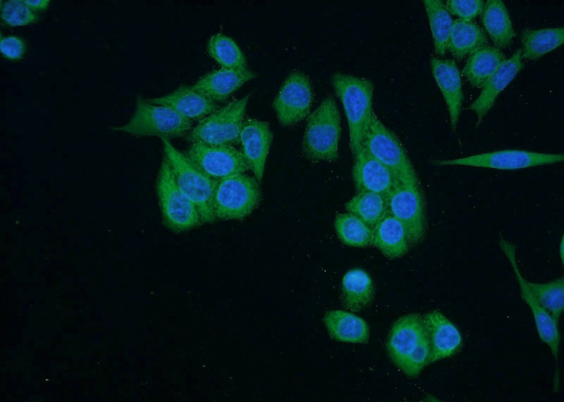 Immunofluorescent analysis of HeLa cells using Catalog No:115189(SH3BP4 Antibody) at dilution of 1:50 and Alexa Fluor 488-congugated AffiniPure Goat Anti-Rabbit IgG(H+L)