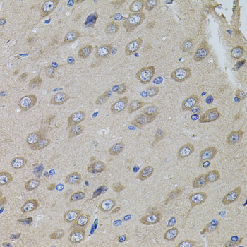 Immunohistochemistry - SUMO3 Polyclonal Antibody 