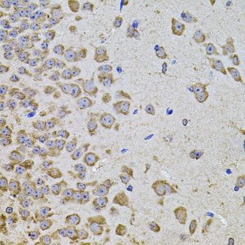 Immunohistochemistry - PIK3CA Polyclonal Antibody 