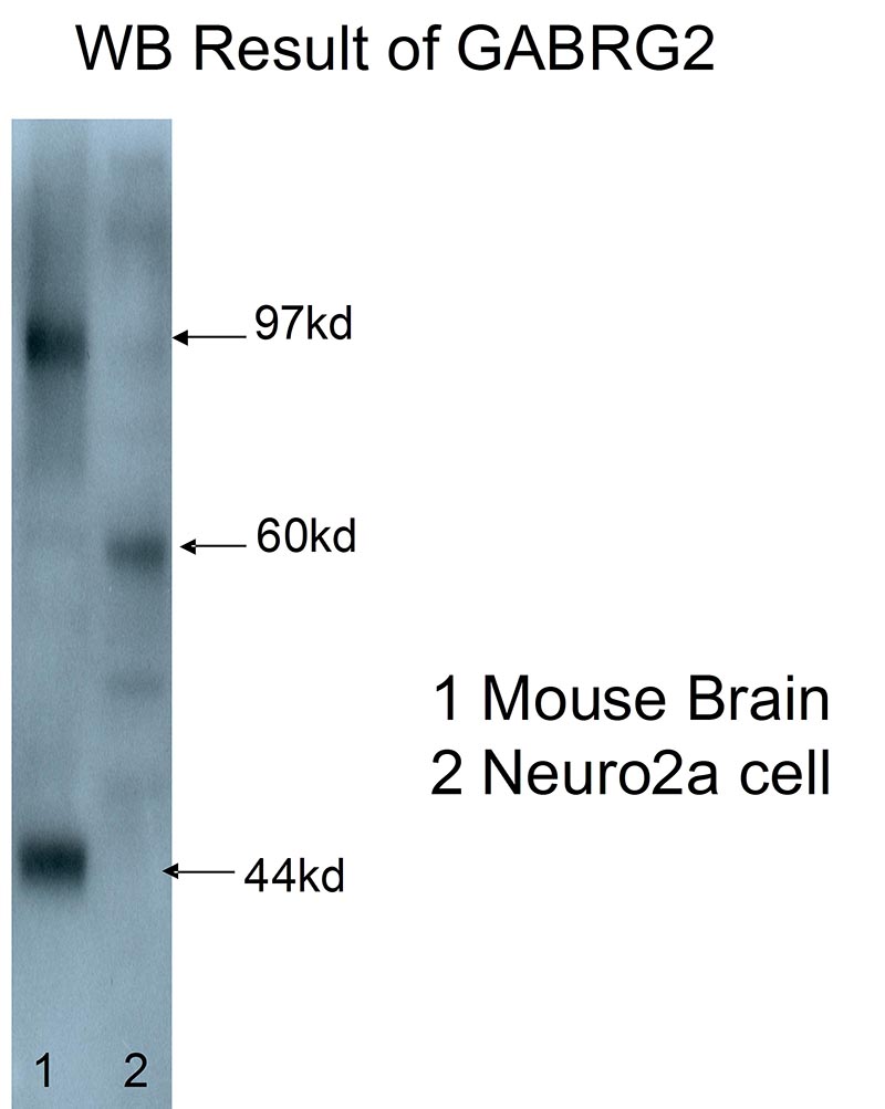 WB result from Dr. Zuyuan Qian(Oregon Health & Science University).anti-GABRG2(Catalog No:110813)