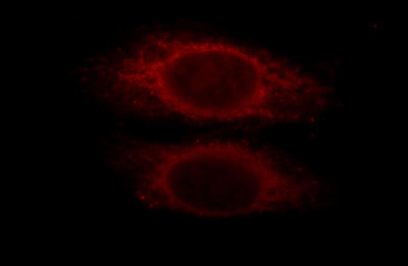 Immunofluorescent analysis of HepG2 cells, using SMAD2 antibody Catalog No:115416 at 1:25 dilution and Rhodamine-labeled goat anti-rabbit IgG (red).