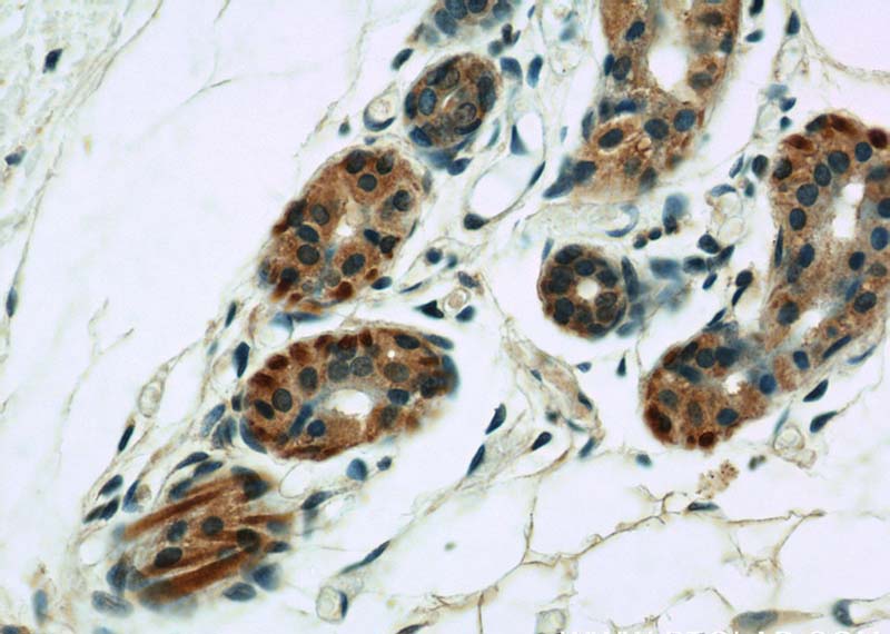 Immunohistochemical of paraffin-embedded human skin using Catalog No:116762(VMA21 antibody) at dilution of 1:50 (under 40x lens)