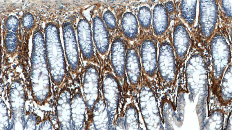 Immunohistochemistry of paraffin-embedded human colon tissue slide using Catalog No:113715(POSTN Antibody) at dilution of 1:200 (under 10x lens).