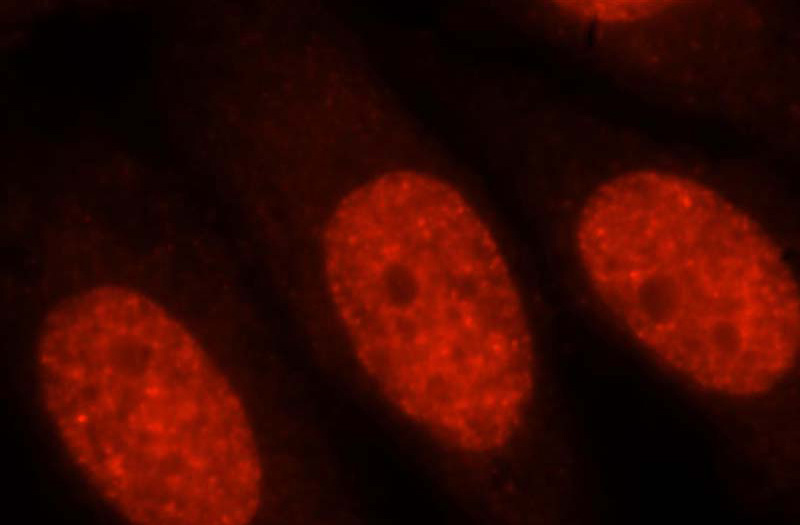 Immunofluorescent analysis of HepG2 cells, using MYEF2 antibody Catalog No:112922 at 1:25 dilution and Rhodamine-labeled goat anti-rabbit IgG (red).