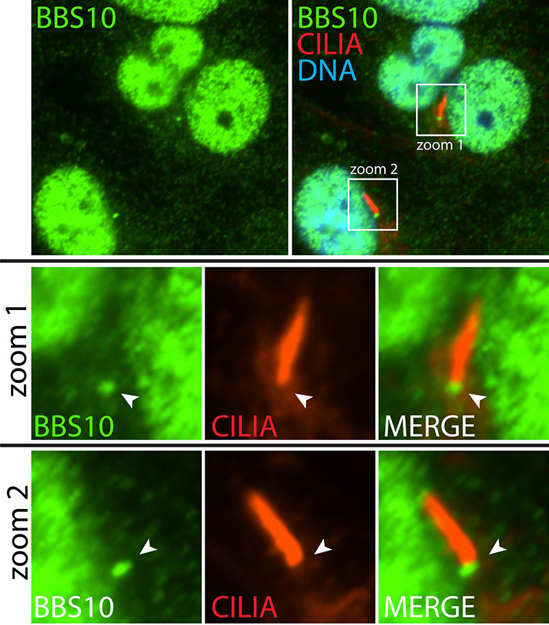 IF result (nuclear and the base of cilia stain) of anti-BBS10 (Catalog No:108368; 1:50) with hTERT-RPE1 cell (PFA fixed) by Dr. Moshe Kim.