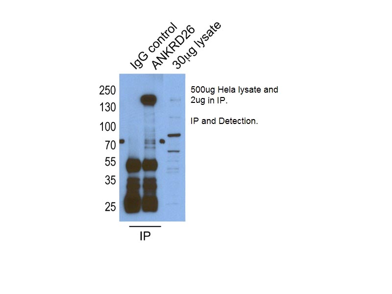 IP result of anti-ANKRD26(Catalog No:108072 for IP and Detection).