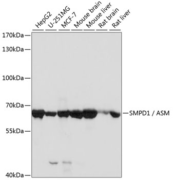 Western blot - SMPD1 / ASM Polyclonal Antibody 
