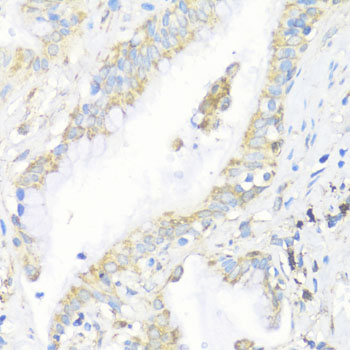 Immunohistochemistry - EIF3J Polyclonal Antibody 