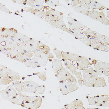 Immunohistochemistry - KDM4A Polyclonal Antibody 