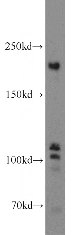 mouse testis tissue were subjected to SDS PAGE followed by western blot with Catalog No:115959(TEX14 antibody) at dilution of 1:500