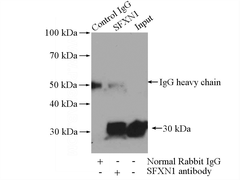 IP Result of anti-SFXN1 (IP:Catalog No:115159, 4ug; Detection:Catalog No:115159 1:800) with mouse brain tissue lysate 4000ug.