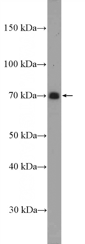 Jurkat cells were subjected to SDS PAGE followed by western blot with Catalog No:115294(SLAMF1 Antibody) at dilution of 1:300