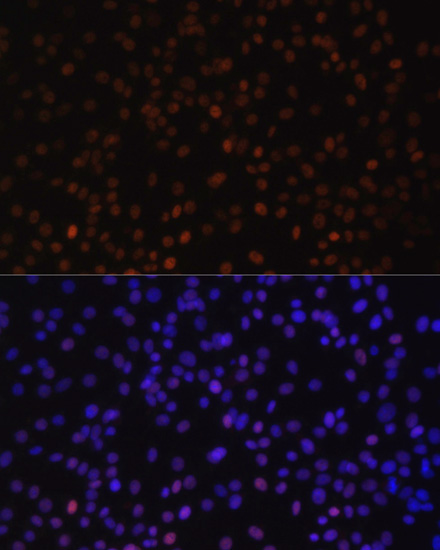 Immunofluorescence - ZEB2 Polyclonal Antibody 