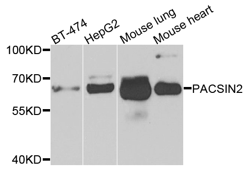 Western blot - PACSIN2 Polyclonal Antibody 
