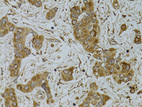 Immunohistochemistry - TNFSF13 Polyclonal Antibody 