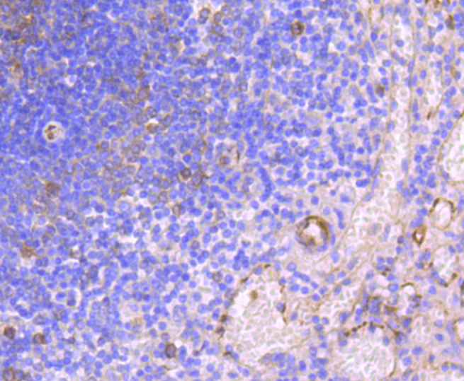 Immunohistochemistry - HAPLN1 Monoclonal Antibody 