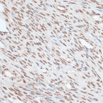 Immunohistochemistry - ZNF574 Polyclonal Antibody 