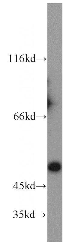 HEK-293 cells were subjected to SDS PAGE followed by western blot with Catalog No:109325(CS antibody) at dilution of 1:2000