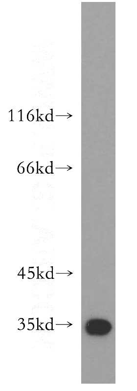 mouse heart tissue were subjected to SDS PAGE followed by western blot with Catalog No:109470(COQ5 antibody) at dilution of 1:500