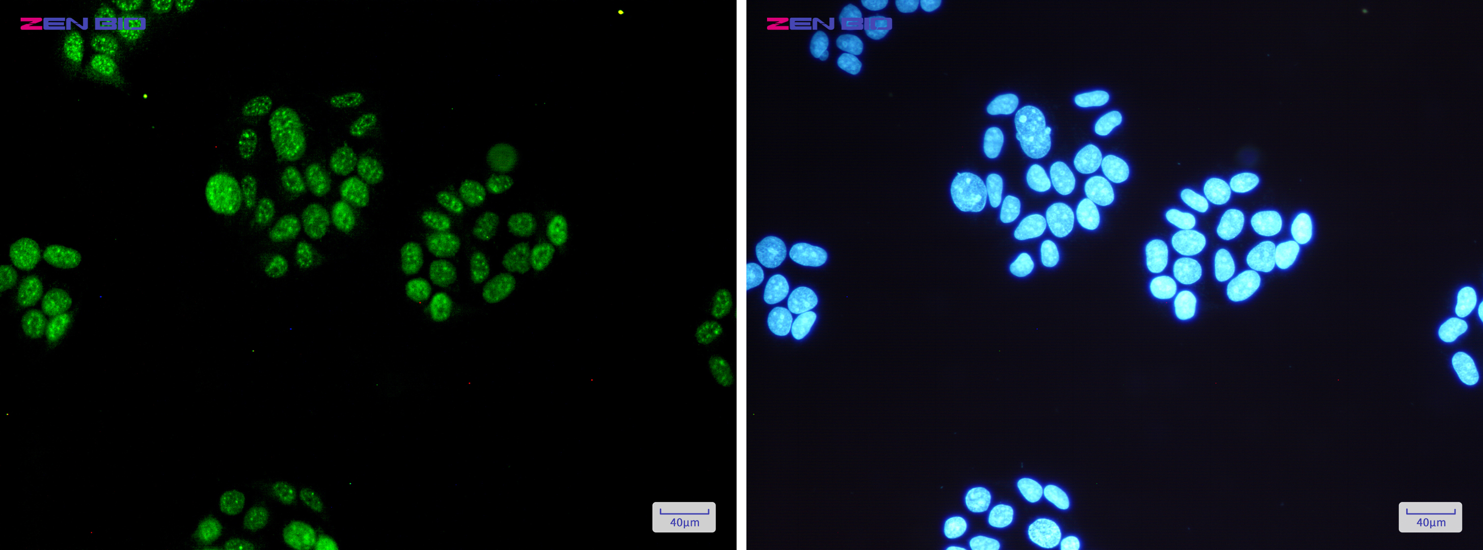 Immunocytochemistry of MSK1 (phospho S360)(green) in Hela cells using MSK1 (phospho S360) Rabbit mAb at dilution 1/200, and DAPI(blue)
