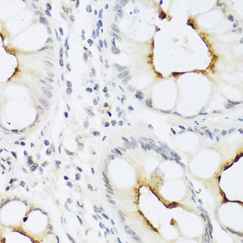 Immunohistochemistry - CCL22 Polyclonal Antibody 